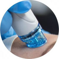 HydraFacial